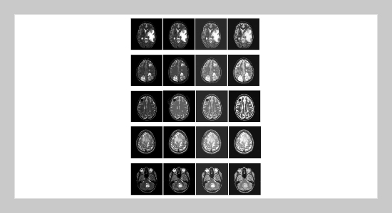 A Deep Feature Fusion Method Based on Dark Channel for Medical Image Segmentation 